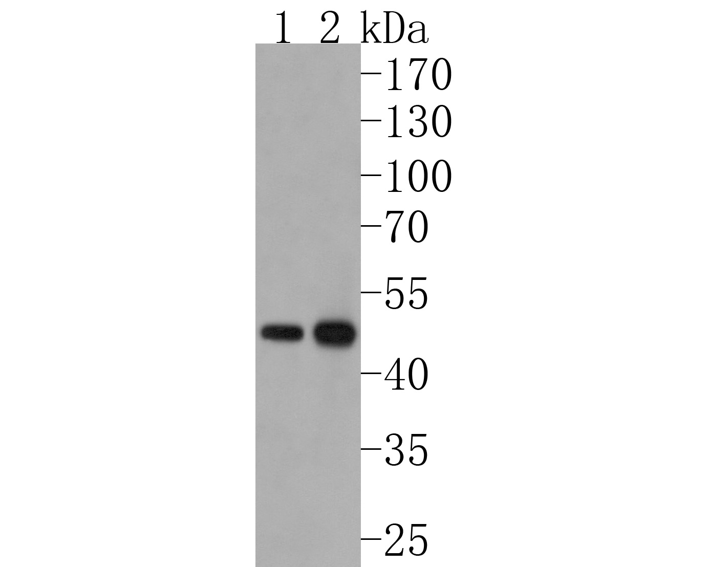 Western blot analysis of FDFT1 on different lysates. Proteins were transferred to a PVDF membrane and blocked with 5% NFDM/TBST for 1 hour at room temperature. The primary antibody (HA720048, 1/500) was used in 5% NFDM/TBST at room temperature for 2 hours. Goat Anti-Rabbit IgG - HRP Secondary Antibody (HA1001) at 1:200,000 dilution was used for 1 hour at room temperature.<br />
Positive control: <br />
Lane 1: HepG2 cell lysate<br />
Lane 2: Rat kidney tissue lysate