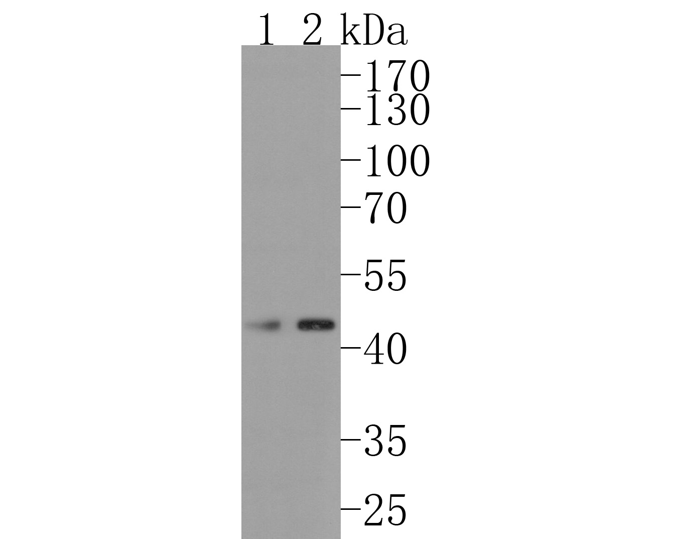 Western blot analysis of FDFT1 on different lysates. Proteins were transferred to a PVDF membrane and blocked with 5% NFDM/TBST for 1 hour at room temperature. The primary antibody (HA720048, 1/500) was used in 5% NFDM/TBST at room temperature for 2 hours. Goat Anti-Rabbit IgG - HRP Secondary Antibody (HA1001) at 1:200,000 dilution was used for 1 hour at room temperature.<br />
Positive control: <br />
Lane 2: SH-SY5Y cell lysate<br />
Lane 1: Mouse brain tissue lysate