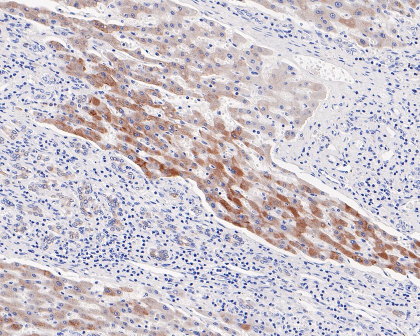 Immunohistochemical analysis of paraffin-embedded human liver tissue using anti-FDFT1 antibody. The section was pre-treated using heat mediated antigen retrieval with Tris-EDTA buffer (pH 9.0) for 20 minutes.The tissues were blocked in 5% BSA for 30 minutes at room temperature, washed with ddH2O and PBS, and then probed with the primary antibody (HA720048, 1/50) for 30 minutes at room temperature. The detection was performed using an HRP conjugated compact polymer system. DAB was used as the chromogen. Tissues were counterstained with hematoxylin and mounted with DPX.