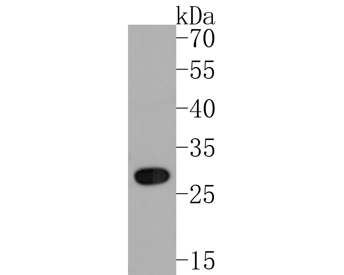 Western blot analysis of 15-PGDH on human placenta tissue lysates. Proteins were transferred to a PVDF membrane and blocked with 5% NFDM/TBST for 1 hour at room temperature. The primary antibody (HA720047, 1/500) was used in 5% NFDM/TBST at room temperature for 2 hours. Goat Anti-Rabbit IgG - HRP Secondary Antibody (HA1001) at 1:200,000 dilution was used for 1 hour at room temperature.