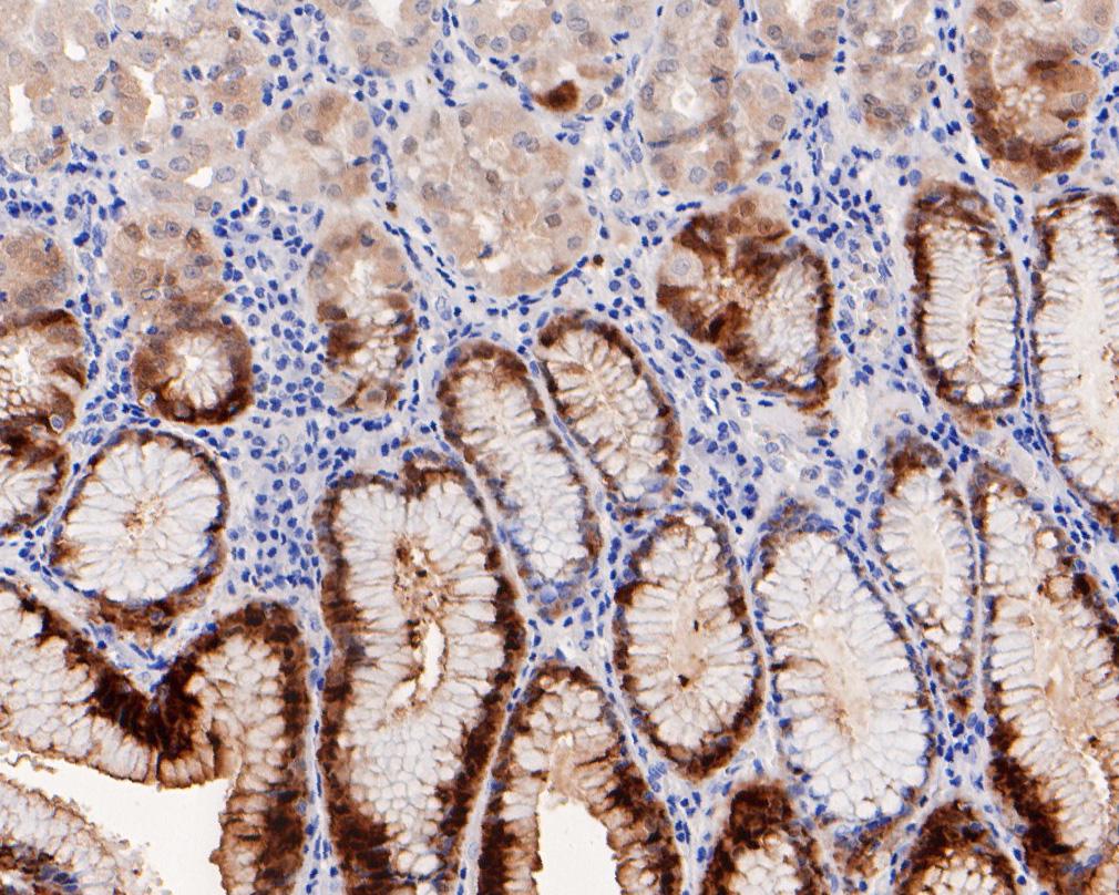 Immunohistochemical analysis of paraffin-embedded human stomach tissue using anti-15-PGDH antibody. The section was pre-treated using heat mediated antigen retrieval with Tris-EDTA buffer (pH 9.0) for 20 minutes.The tissues were blocked in 5% BSA for 30 minutes at room temperature, washed with ddH2O and PBS, and then probed with the primary antibody (HA720047, 1/50) for 30 minutes at room temperature. The detection was performed using an HRP conjugated compact polymer system. DAB was used as the chromogen. Tissues were counterstained with hematoxylin and mounted with DPX.