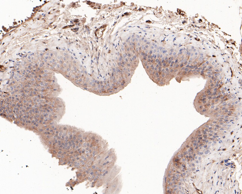 Immunohistochemical analysis of paraffin-embedded mouse bladder tissue using anti-15-PGDH antibody. The section was pre-treated using heat mediated antigen retrieval with Tris-EDTA buffer (pH 9.0) for 20 minutes.The tissues were blocked in 5% BSA for 30 minutes at room temperature, washed with ddH2O and PBS, and then probed with the primary antibody (HA720047, 1/50) for 30 minutes at room temperature. The detection was performed using an HRP conjugated compact polymer system. DAB was used as the chromogen. Tissues were counterstained with hematoxylin and mounted with DPX.