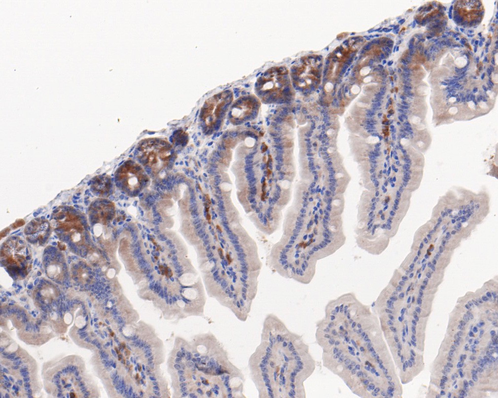Immunohistochemical analysis of paraffin-embedded mouse colon tissue using anti-Elp3 antibody. The section was pre-treated using heat mediated antigen retrieval with sodium citrate buffer (pH 6.0) for 20 minutes. The tissues were blocked in 5% BSA for 30 minutes at room temperature, washed with ddH2O and PBS, and then probed with the primary antibody (HA720046, 1/50)  for 30 minutes at room temperature. The detection was performed using an HRP conjugated compact polymer system. DAB was used as the chromogen. Tissues were counterstained with hematoxylin and mounted with DPX.
