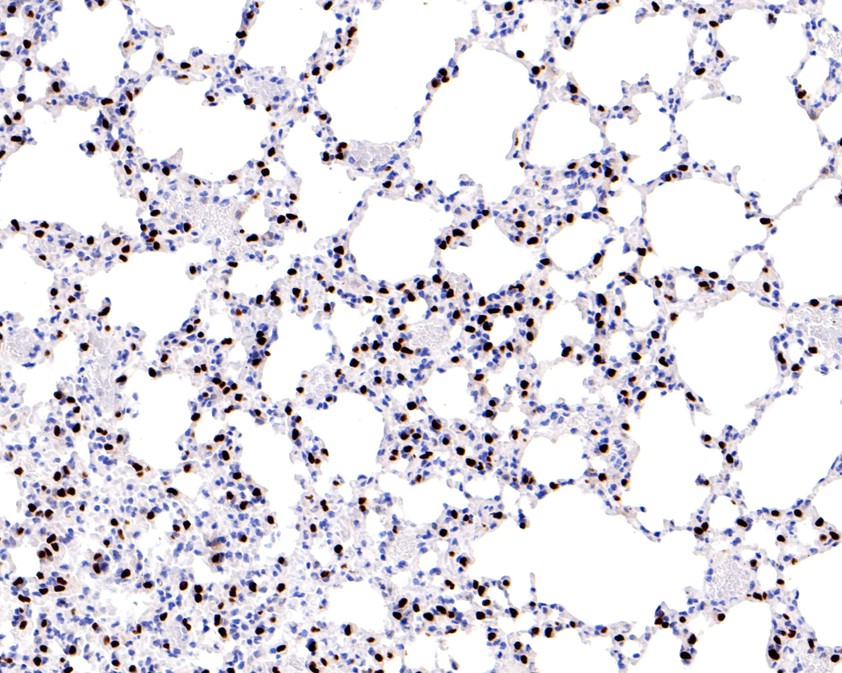 Immunohistochemical analysis of paraffin-embedded rat lung tissue using anti-TTF1 antibody. The section was pre-treated using heat mediated antigen retrieval with sodium citrate buffer (pH 6.0) for 20 minutes. The tissues were blocked in 5% BSA for 30 minutes at room temperature, washed with ddH2O and PBS, and then probed with the primary antibody (HA720067, 1/2,000)  for 30 minutes at room temperature. The detection was performed using an HRP conjugated compact polymer system. DAB was used as the chromogen. Tissues were counterstained with hematoxylin and mounted with DPX.