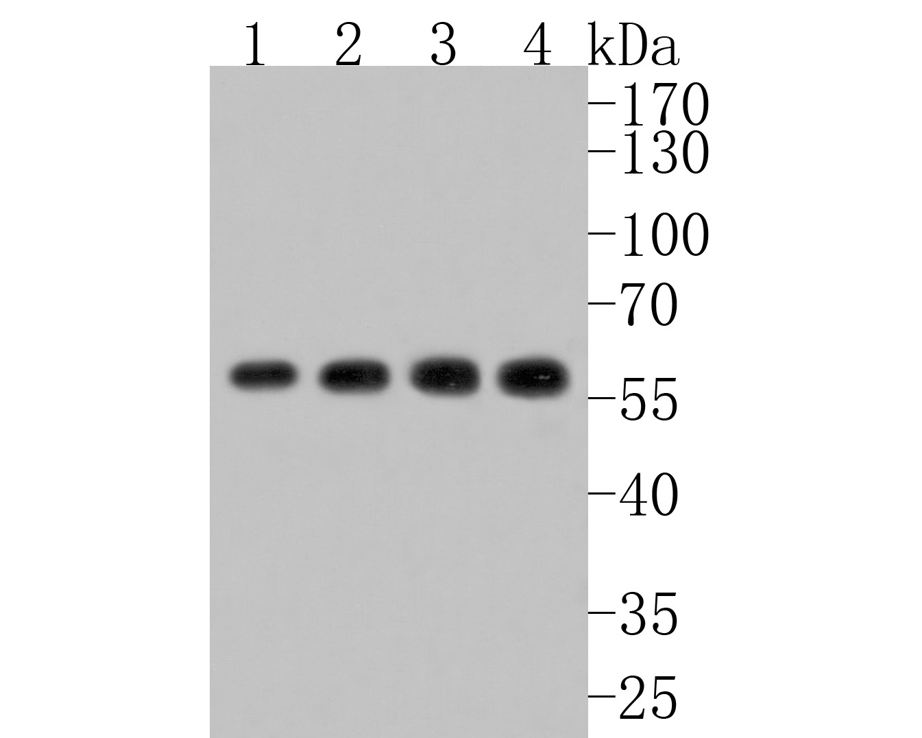 Western blot analysis of CAP1 on different lysates. Proteins were transferred to a PVDF membrane and blocked with 5% NFDM/TBST for 1 hour at room temperature. The primary antibody (HA720069, 1/500) was used in 5% NFDM/TBST at room temperature for 2 hours. Goat Anti-Rabbit IgG - HRP Secondary Antibody (HA1001) at 1:200,000 dilution was used for 1 hour at room temperature.<br />
Positive control: <br />
Lane 1: Hela cell lysate<br />
Lane 2: A431 cell lysate<br />
Lane 1: HepG2 cell lysate<br />
Lane 2: Raji cell lysate