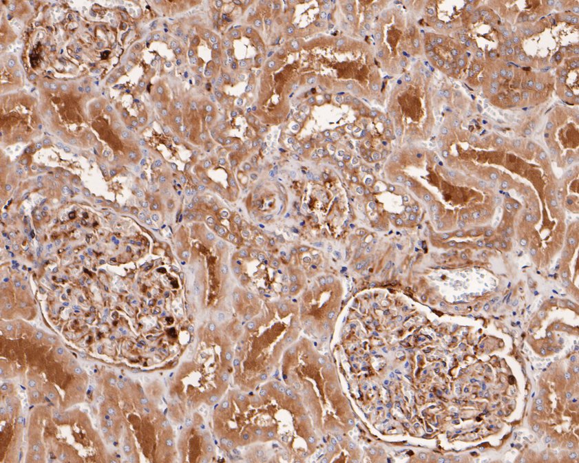 Immunohistochemical analysis of paraffin-embedded human kidney tissue using anti-CAP1 antibody. The section was pre-treated using heat mediated antigen retrieval with Tris-EDTA buffer (pH 8.0-8.4) for 20 minutes.The tissues were blocked in 5% BSA for 30 minutes at room temperature, washed with ddH2O and PBS, and then probed with the primary antibody (HA720069, 1/200) for 30 minutes at room temperature. The detection was performed using an HRP conjugated compact polymer system. DAB was used as the chromogen. Tissues were counterstained with hematoxylin and mounted with DPX.