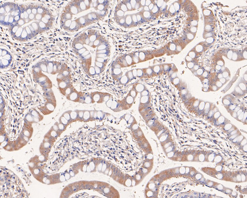 Immunohistochemical analysis of paraffin-embedded human small intestine tissue using anti-NK-p44 antibody. The section was pre-treated using heat mediated antigen retrieval with Tris-EDTA buffer (pH 8.0-8.4) for 20 minutes.The tissues were blocked in 5% BSA for 30 minutes at room temperature, washed with ddH2O and PBS, and then probed with the primary antibody (HA720070, 1/50) for 30 minutes at room temperature. The detection was performed using an HRP conjugated compact polymer system. DAB was used as the chromogen. Tissues were counterstained with hematoxylin and mounted with DPX.