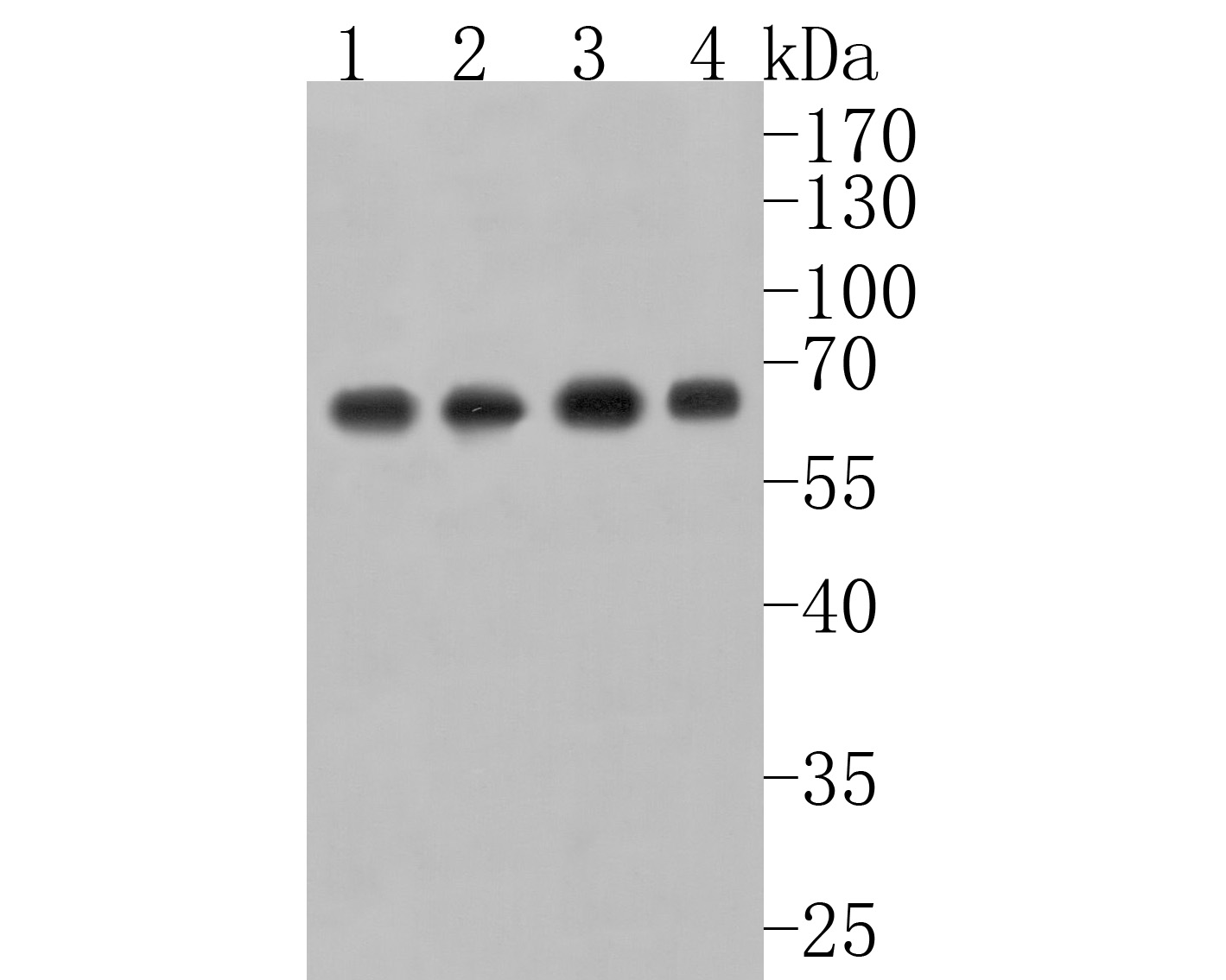 Western blot analysis of USP39 on different lysates. Proteins were transferred to a PVDF membrane and blocked with 5% BSA in PBS for 1 hour at room temperature. The primary antibody (HA720071, 1/500) was used in 5% BSA at room temperature for 2 hours. Goat Anti-Rabbit IgG - HRP Secondary Antibody (HA1001) at 1:200,000 dilution was used for 1 hour at room temperature.<br />
Positive control: <br />
Lane 1: Hela cell lysate<br />
Lane 2: 293T cell lysate<br />
Lane 3: Jurkat cell lysate<br />
Lane 4: Mouse lung tissue lysate