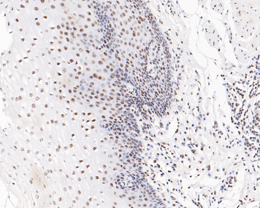 Immunohistochemical analysis of paraffin-embedded human esophagus tissue using anti-USP39 antibody. The section was pre-treated using heat mediated antigen retrieval with sodium citrate buffer (pH 6.0) for 20 minutes. The tissues were blocked in 5% BSA for 30 minutes at room temperature, washed with ddH2O and PBS, and then probed with the primary antibody (HA720071, 1/200)  for 30 minutes at room temperature. The detection was performed using an HRP conjugated compact polymer system. DAB was used as the chromogen. Tissues were counterstained with hematoxylin and mounted with DPX.