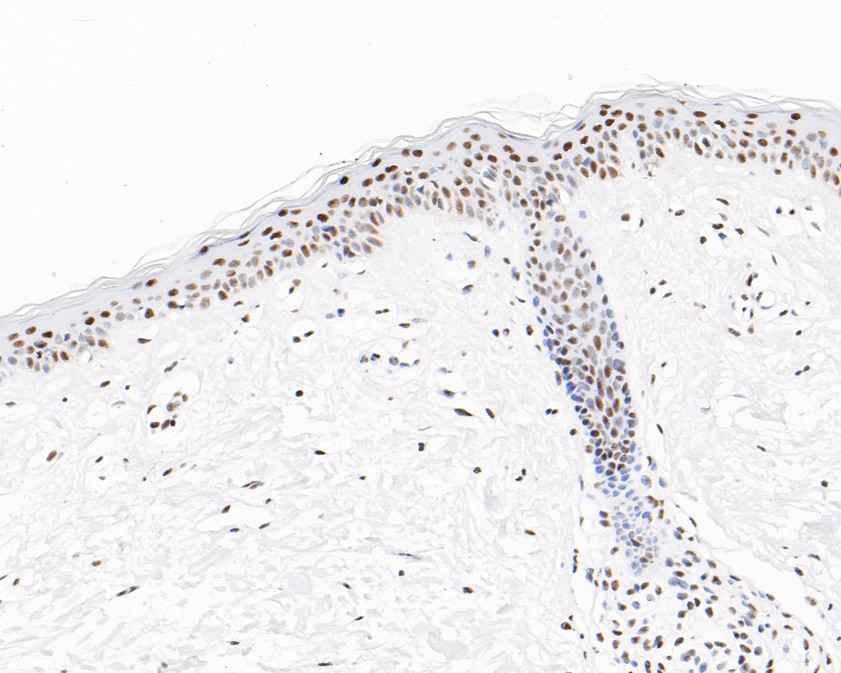 Immunohistochemical analysis of paraffin-embedded human skin tissue using anti-USP39 antibody. The section was pre-treated using heat mediated antigen retrieval with sodium citrate buffer (pH 6.0) for 20 minutes. The tissues were blocked in 5% BSA for 30 minutes at room temperature, washed with ddH2O and PBS, and then probed with the primary antibody (HA720071, 1/200)  for 30 minutes at room temperature. The detection was performed using an HRP conjugated compact polymer system. DAB was used as the chromogen. Tissues were counterstained with hematoxylin and mounted with DPX.