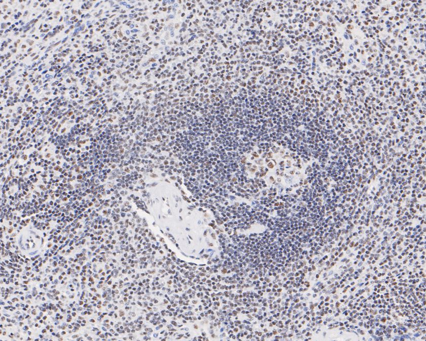 Immunohistochemical analysis of paraffin-embedded human spleen tissue using anti-USP39 antibody. The section was pre-treated using heat mediated antigen retrieval with sodium citrate buffer (pH 6.0) for 20 minutes. The tissues were blocked in 5% BSA for 30 minutes at room temperature, washed with ddH2O and PBS, and then probed with the primary antibody (HA720071, 1/200)  for 30 minutes at room temperature. The detection was performed using an HRP conjugated compact polymer system. DAB was used as the chromogen. Tissues were counterstained with hematoxylin and mounted with DPX.