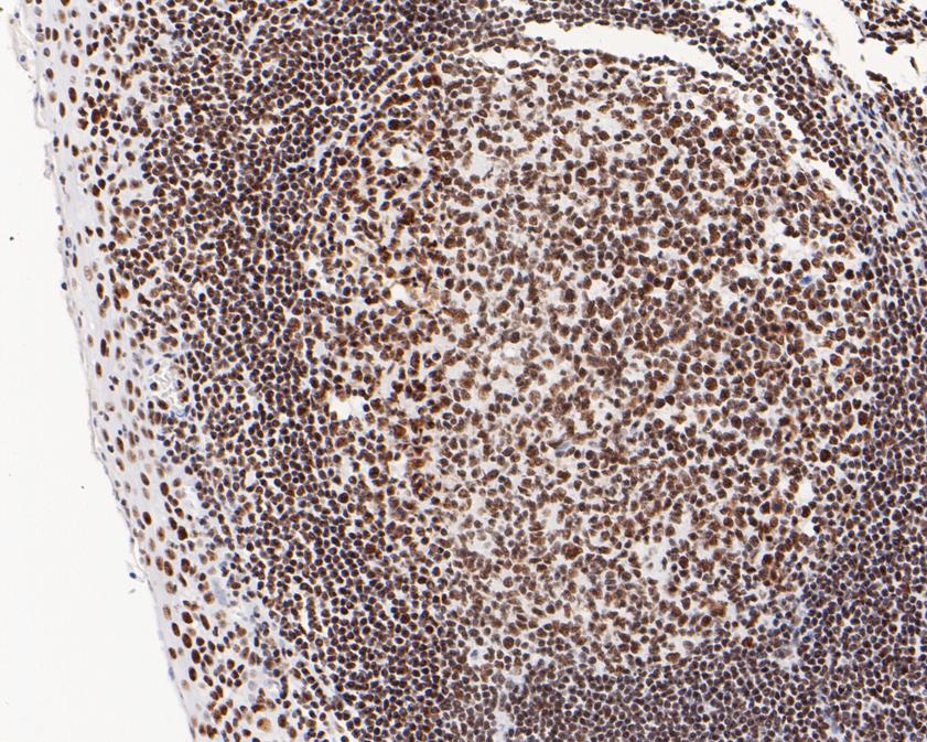 Immunohistochemical analysis of paraffin-embedded human tonsil tissue using anti-USP39 antibody. The section was pre-treated using heat mediated antigen retrieval with sodium citrate buffer (pH 6.0) for 20 minutes. The tissues were blocked in 5% BSA for 30 minutes at room temperature, washed with ddH2O and PBS, and then probed with the primary antibody (HA720071, 1/200)  for 30 minutes at room temperature. The detection was performed using an HRP conjugated compact polymer system. DAB was used as the chromogen. Tissues were counterstained with hematoxylin and mounted with DPX.