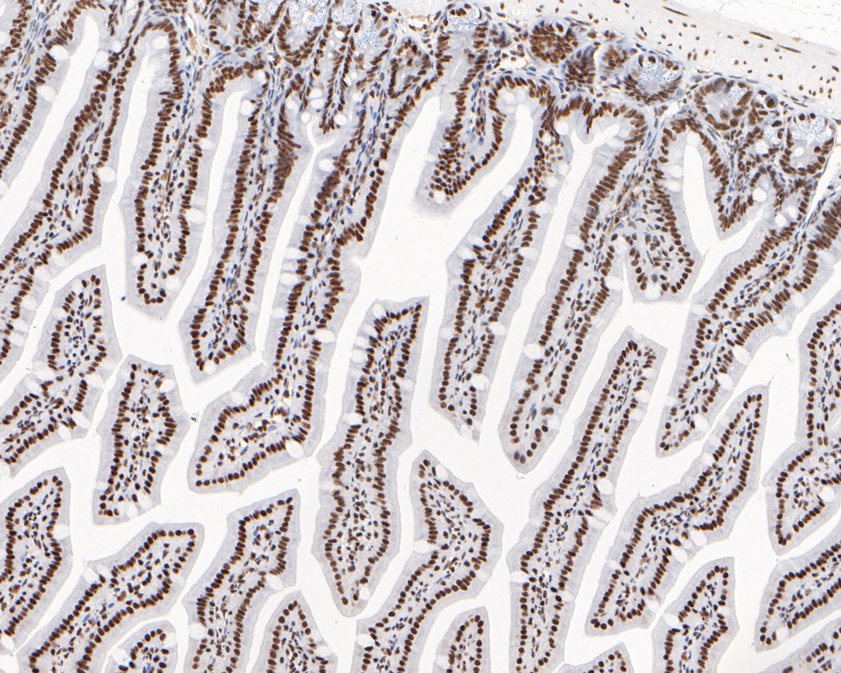 Immunohistochemical analysis of paraffin-embedded mouse colon tissue using anti-USP39 antibody. The section was pre-treated using heat mediated antigen retrieval with sodium citrate buffer (pH 6.0) for 20 minutes. The tissues were blocked in 5% BSA for 30 minutes at room temperature, washed with ddH2O and PBS, and then probed with the primary antibody (HA720071, 1/200)  for 30 minutes at room temperature. The detection was performed using an HRP conjugated compact polymer system. DAB was used as the chromogen. Tissues were counterstained with hematoxylin and mounted with DPX.