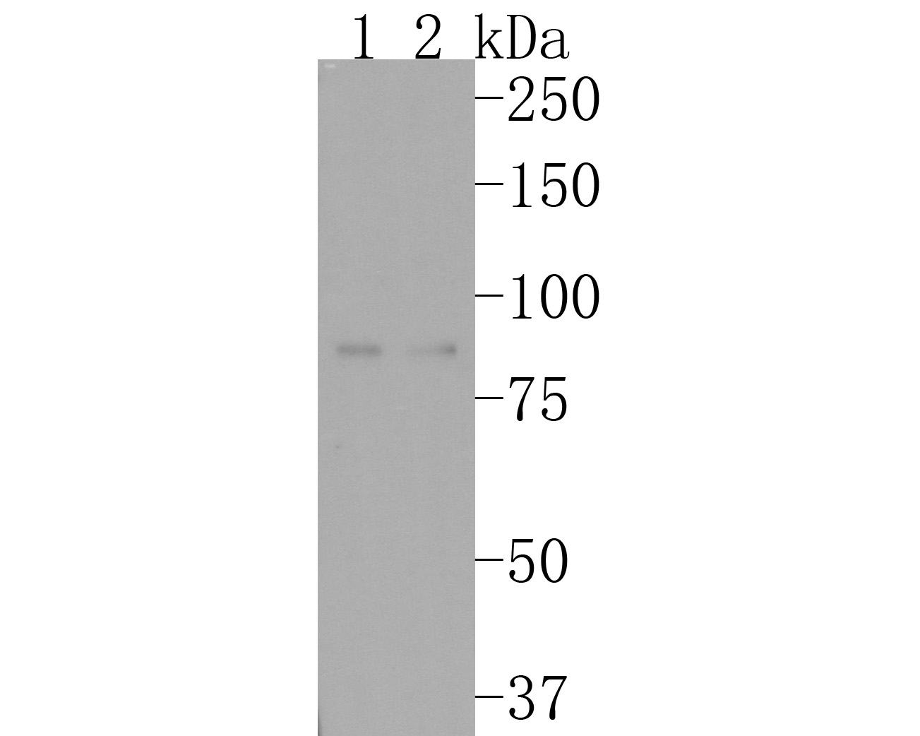 Western blot analysis of CD105 on different lysates. Proteins were transferred to a PVDF membrane and blocked with 5% NFDM/TBST for 1 hour at room temperature. The primary antibody (HA720072, 1/500) was used in 5% NFDM/TBST at room temperature for 2 hours. Goat Anti-Rabbit IgG - HRP Secondary Antibody (HA1001) at 1:200,000 dilution was used for 1 hour at room temperature.<br />
Positive control: <br />
Lane 1: Human placenta tissue lysate<br />
Lane 2: JAR cell lysate