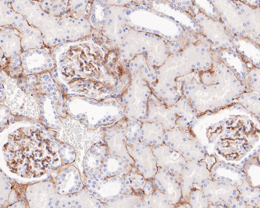 Immunohistochemical analysis of paraffin-embedded human kidney tissue using anti-CD105 antibody. The section was pre-treated using heat mediated antigen retrieval with Tris-EDTA buffer (pH 8.0-8.4) for 20 minutes.The tissues were blocked in 5% BSA for 30 minutes at room temperature, washed with ddH2O and PBS, and then probed with the primary antibody (HA720072, 1/200) for 30 minutes at room temperature. The detection was performed using an HRP conjugated compact polymer system. DAB was used as the chromogen. Tissues were counterstained with hematoxylin and mounted with DPX.