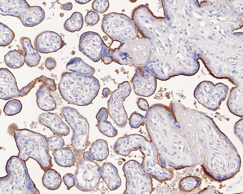 Immunohistochemical analysis of paraffin-embedded human placenta tissue using anti-CD105 antibody. The section was pre-treated using heat mediated antigen retrieval with Tris-EDTA buffer (pH 8.0-8.4) for 20 minutes.The tissues were blocked in 5% BSA for 30 minutes at room temperature, washed with ddH2O and PBS, and then probed with the primary antibody (HA720072, 1/50) for 30 minutes at room temperature. The detection was performed using an HRP conjugated compact polymer system. DAB was used as the chromogen. Tissues were counterstained with hematoxylin and mounted with DPX.