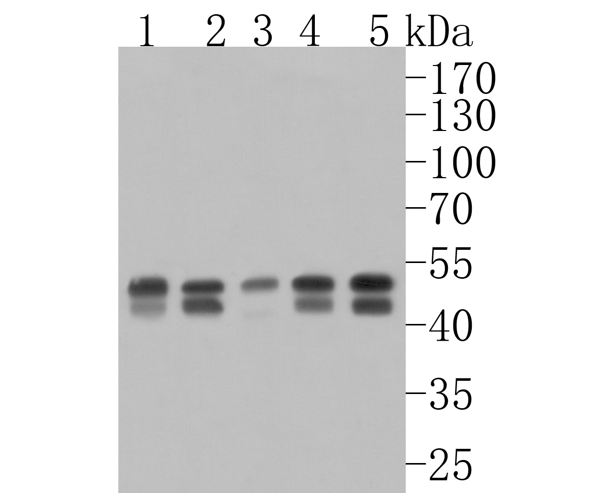 Western blot analysis of TCPTP on different lysates. Proteins were transferred to a PVDF membrane and blocked with 5% NFDM/TBST for 1 hour at room temperature. The primary antibody (HA720074, 1/500) was used in 5% NFDM/TBST at room temperature for 2 hours. Goat Anti-Rabbit IgG - HRP Secondary Antibody (HA1001) at 1:200,000 dilution was used for 1 hour at room temperature.<br />
Positive control: <br />
Lane 1: K562 cell lysate<br />
Lane 2: Mouse testis tissue lysate<br />
Lane 3: Rat testis tissue lysate<br />
Lane 4: HL-60 cell lysate<br />
Lane 5: Jurkat cell lysate