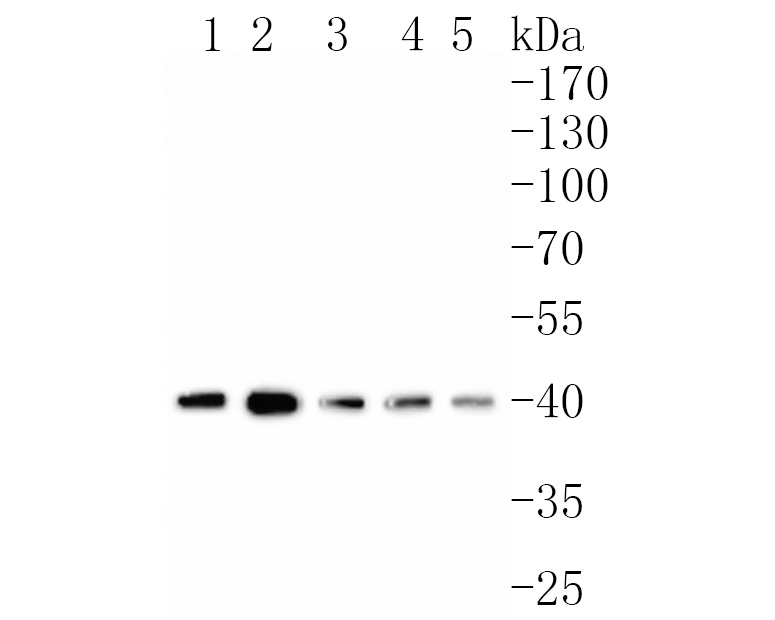 Western blot analysis of Spermine synthase on different lysates. Proteins were transferred to a PVDF membrane and blocked with 5% NFDM/TBST for 1 hour at room temperature. The primary antibody (HA720065, 1/500) was used in 5% NFDM/TBST at room temperature for 2 hours. Goat Anti-Rabbit IgG - HRP Secondary Antibody (HA1001) at 1:200,000 dilution was used for 1 hour at room temperature.<br />
Positive control: <br />
Lane 1: Hela cell lysate<br />
Lane 2: Jurkat cell lysate<br />
Lane 3: K562 cell lysate<br />
Lane 4: Rat uterus tissue lysate<br />
Lane 5: Mouse testis tissue lysate
