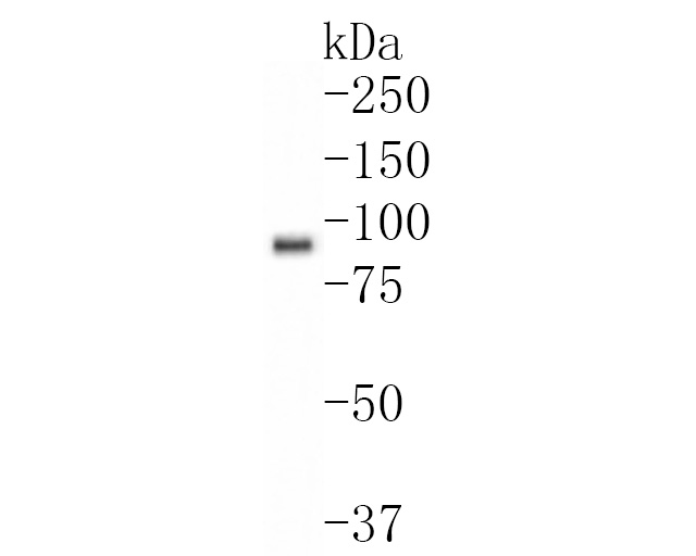 Western blot analysis of PPM1E on Daudi cell lysates. Proteins were transferred to a PVDF membrane and blocked with 5% BSA in PBS for 1 hour at room temperature. The primary antibody (HA720063, 1/500) was used in 5% BSA at room temperature for 2 hours. Goat Anti-Rabbit IgG - HRP Secondary Antibody (HA1001) at 1:200,000 dilution was used for 1 hour at room temperature.