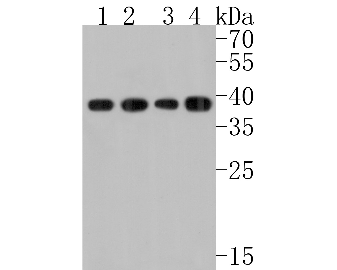 Western blot analysis of WDR68 on different lysates. Proteins were transferred to a PVDF membrane and blocked with 5% NFDM/TBST for 1 hour at room temperature. The primary antibody (HA720062, 1/500) was used in 5% NFDM/TBST at room temperature for 2 hours. Goat Anti-Rabbit IgG - HRP Secondary Antibody (HA1001) at 1:200,000 dilution was used for 1 hour at room temperature.<br />
Positive control: <br />
Lane 1: Hela cell lysate<br />
Lane 2: 293 cell lysate<br />
Lane 3: Mouse lung tissue lysate<br />
Lane 4: SH-SY5Y cell lysate