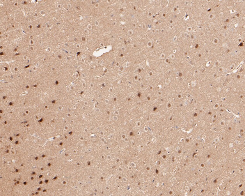 Immunohistochemical analysis of paraffin-embedded mouse brain tissue using anti-WDR68 antibody. The section was pre-treated using heat mediated antigen retrieval with sodium citrate buffer (pH 6.0) for 20 minutes. The tissues were blocked in 5% BSA for 30 minutes at room temperature, washed with ddH2O and PBS, and then probed with the primary antibody (HA720062, 1/50)  for 30 minutes at room temperature. The detection was performed using an HRP conjugated compact polymer system. DAB was used as the chromogen. Tissues were counterstained with hematoxylin and mounted with DPX.