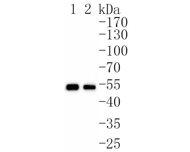 Western blot analysis of SAMM50 on different lysates. Proteins were transferred to a PVDF membrane and blocked with 5% NFDM/TBST for 1 hour at room temperature. The primary antibody (HA720059, 1/500) was used in 5% NFDM/TBST at room temperature for 2 hours. Goat Anti-Rabbit IgG - HRP Secondary Antibody (HA1001) at 1:200,000 dilution was used for 1 hour at room temperature.<br />
Positive control: <br />
Lane 1: Mouse pancreas tissue lysate<br />
Lane 2: Rat pancreas tissue lysate