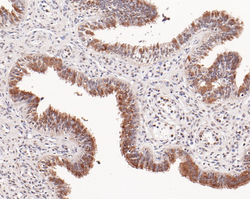 Immunohistochemical analysis of paraffin-embedded human fallopian tube tissue using anti-HOOK2 antibody. The section was pre-treated using heat mediated antigen retrieval with Tris-EDTA buffer (pH 9.0) for 20 minutes.The tissues were blocked in 5% BSA for 30 minutes at room temperature, washed with ddH2O and PBS, and then probed with the primary antibody (HA720057, 1/50) for 30 minutes at room temperature. The detection was performed using an HRP conjugated compact polymer system. DAB was used as the chromogen. Tissues were counterstained with hematoxylin and mounted with DPX.