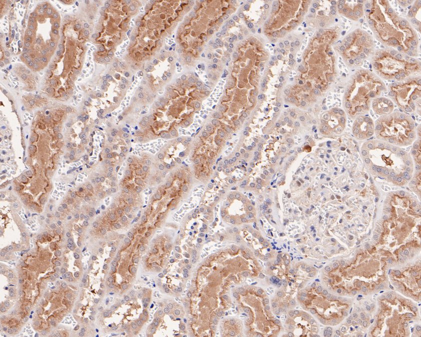 Immunohistochemical analysis of paraffin-embedded human kidney tissue using anti-HOOK2 antibody. The section was pre-treated using heat mediated antigen retrieval with Tris-EDTA buffer (pH 9.0) for 20 minutes.The tissues were blocked in 5% BSA for 30 minutes at room temperature, washed with ddH2O and PBS, and then probed with the primary antibody (HA720057, 1/50) for 30 minutes at room temperature. The detection was performed using an HRP conjugated compact polymer system. DAB was used as the chromogen. Tissues were counterstained with hematoxylin and mounted with DPX.