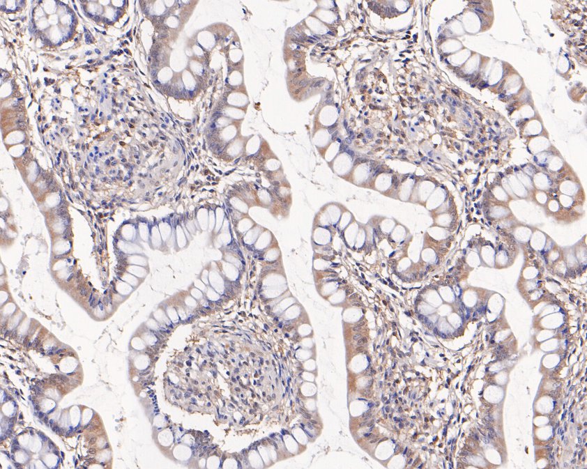 Immunohistochemical analysis of paraffin-embedded human small intestine tissue using anti-HOOK2 antibody. The section was pre-treated using heat mediated antigen retrieval with Tris-EDTA buffer (pH 9.0) for 20 minutes.The tissues were blocked in 5% BSA for 30 minutes at room temperature, washed with ddH2O and PBS, and then probed with the primary antibody (HA720057, 1/50) for 30 minutes at room temperature. The detection was performed using an HRP conjugated compact polymer system. DAB was used as the chromogen. Tissues were counterstained with hematoxylin and mounted with DPX.
