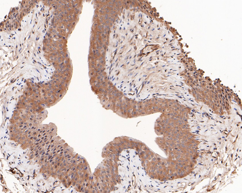Immunohistochemical analysis of paraffin-embedded mouse bladder tissue using anti-HOOK2 antibody. The section was pre-treated using heat mediated antigen retrieval with Tris-EDTA buffer (pH 9.0) for 20 minutes.The tissues were blocked in 5% BSA for 30 minutes at room temperature, washed with ddH2O and PBS, and then probed with the primary antibody (HA720057, 1/50) for 30 minutes at room temperature. The detection was performed using an HRP conjugated compact polymer system. DAB was used as the chromogen. Tissues were counterstained with hematoxylin and mounted with DPX.