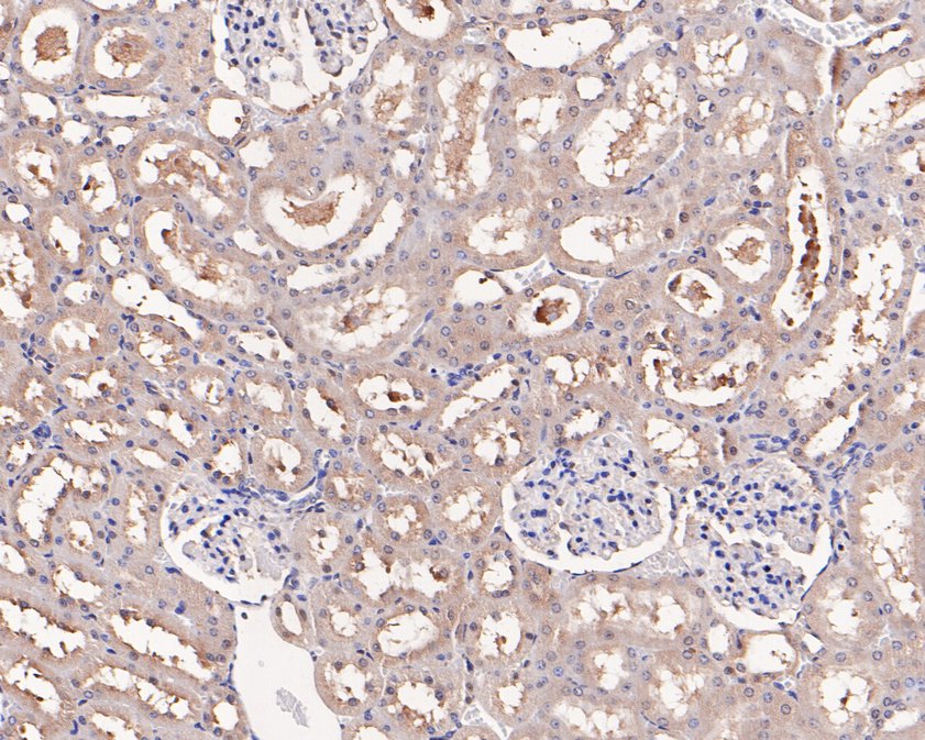 Immunohistochemical analysis of paraffin-embedded rat kidney tissue using anti-HOOK2 antibody. The section was pre-treated using heat mediated antigen retrieval with Tris-EDTA buffer (pH 9.0) for 20 minutes.The tissues were blocked in 5% BSA for 30 minutes at room temperature, washed with ddH2O and PBS, and then probed with the primary antibody (HA720057, 1/50) for 30 minutes at room temperature. The detection was performed using an HRP conjugated compact polymer system. DAB was used as the chromogen. Tissues were counterstained with hematoxylin and mounted with DPX.