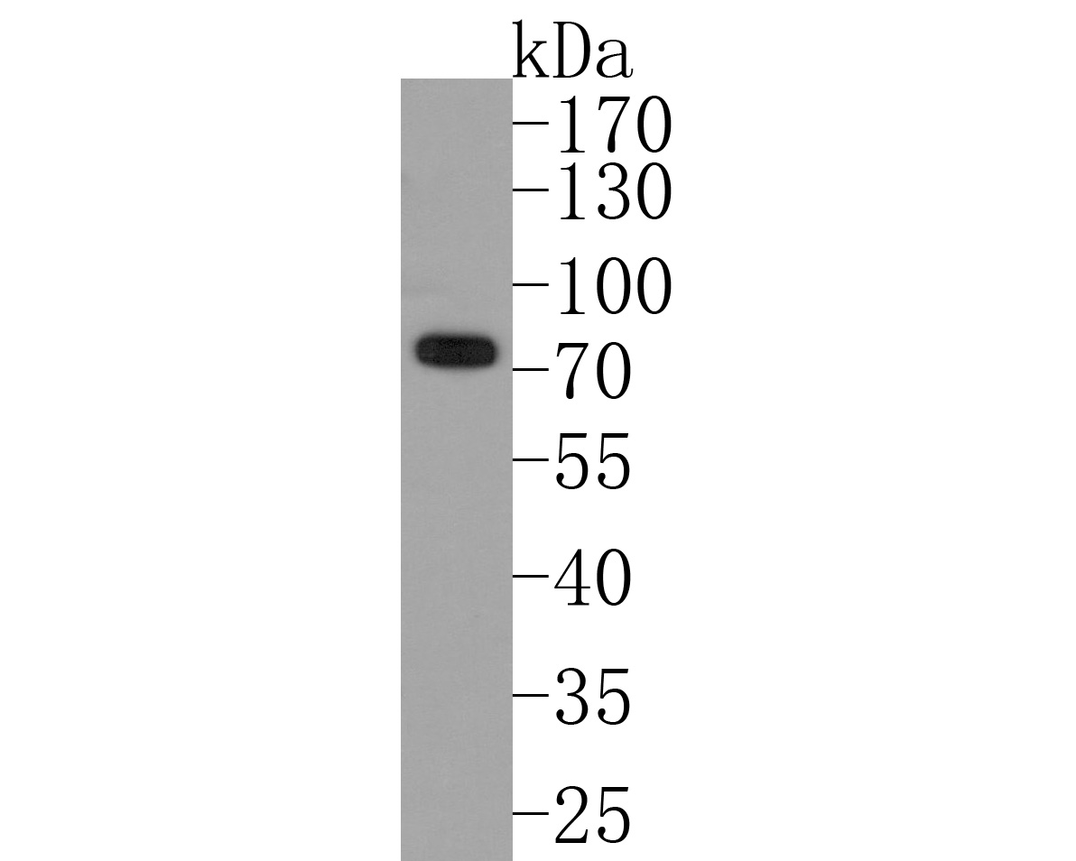 Western blot analysis of PIAS1 on 293T cell lysates. Proteins were transferred to a PVDF membrane and blocked with 5% BSA in PBS for 1 hour at room temperature. The primary antibody (HA720076, 1/500) was used in 5% BSA at room temperature for 2 hours. Goat Anti-Rabbit IgG - HRP Secondary Antibody (HA1001) at 1:200,000 dilution was used for 1 hour at room temperature.