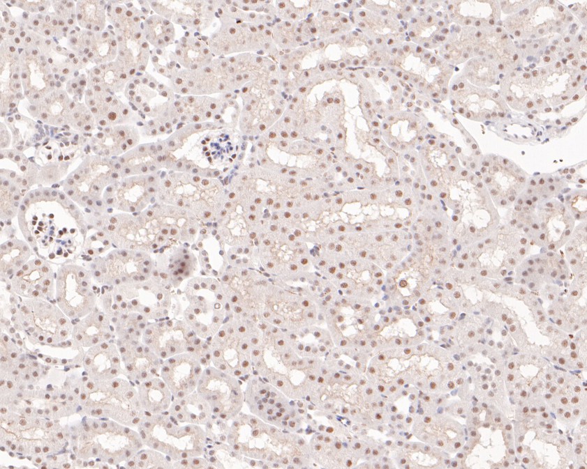 Immunohistochemical analysis of paraffin-embedded mouse kidney tissue using anti-PIAS1 antibody. The section was pre-treated using heat mediated antigen retrieval with sodium citrate buffer (pH 6.0) for 20 minutes. The tissues were blocked in 5% BSA for 30 minutes at room temperature, washed with ddH2O and PBS, and then probed with the primary antibody (HA720076, 1/200)  for 30 minutes at room temperature. The detection was performed using an HRP conjugated compact polymer system. DAB was used as the chromogen. Tissues were counterstained with hematoxylin and mounted with DPX.