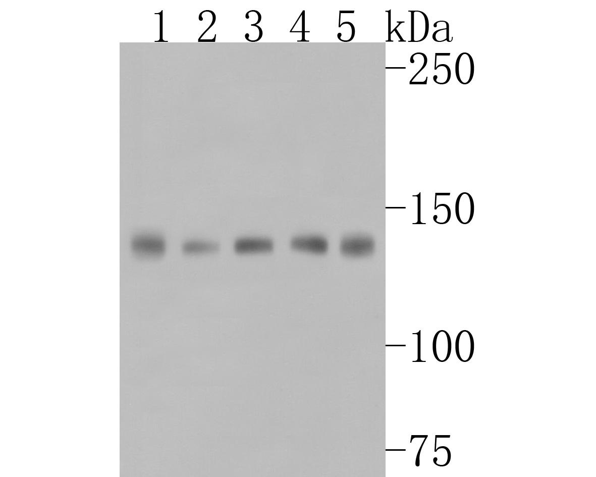 Western blot analysis of Met (c-Met) on different lysates. Proteins were transferred to a PVDF membrane and blocked with 5% BSA in PBS for 1 hour at room temperature. The primary antibody (HA500242, 1/500) was used in 5% BSA at room temperature for 2 hours. Goat Anti-Rabbit IgG - HRP Secondary Antibody (HA1001) at 1:200,000 dilution was used for 1 hour at room temperature.<br />
Positive control: <br />
Lane 2: LO2 cell lysate<br />
Lane 2: Hela cell lysate<br />
Lane 2: A549 cell lysate<br />
Lane 2: A431 cell lysate<br />
Lane 2: HT-29 cell lysate