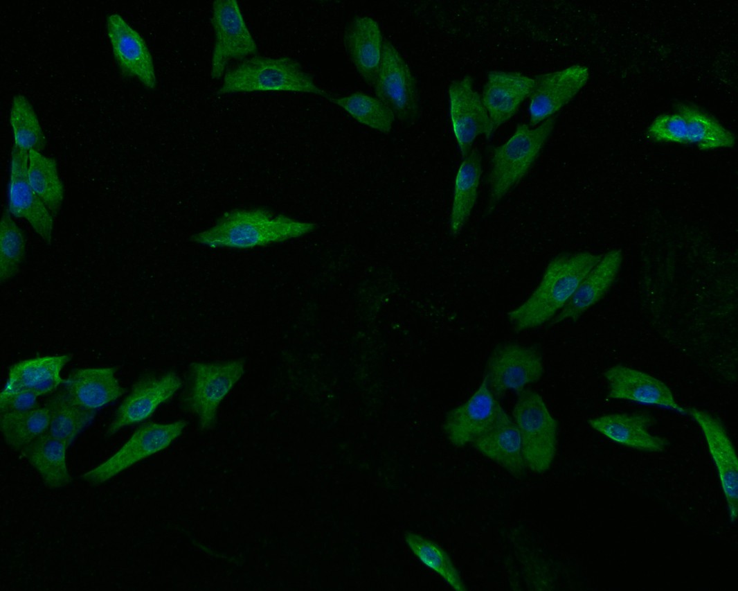ICC staining of EDN3 in MG-63 cells (green). Formalin fixed cells were permeabilized with 0.1% Triton X-100 in TBS for 10 minutes at room temperature and blocked with 1% Blocker BSA for 15 minutes at room temperature. Cells were probed with the primary antibody (HA500241, 1/100) for 1 hour at room temperature, washed with PBS. Alexa Fluor®488 Goat anti-Rabbit IgG was used as the secondary antibody at 1/1,000 dilution. The nuclear counter stain is DAPI (blue).