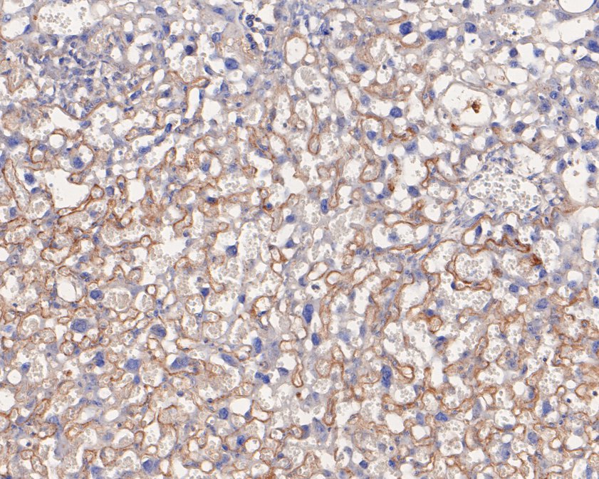 Immunohistochemical analysis of paraffin-embedded mouse placenta tissue using anti-EDN3 antibody. The section was pre-treated using heat mediated antigen retrieval with Tris-EDTA buffer (pH 9.0) for 20 minutes.The tissues were blocked in 5% BSA for 30 minutes at room temperature, washed with ddH2O and PBS, and then probed with the primary antibody (HA500241, 1/100) for 30 minutes at room temperature. The detection was performed using an HRP conjugated compact polymer system. DAB was used as the chromogen. Tissues were counterstained with hematoxylin and mounted with DPX.