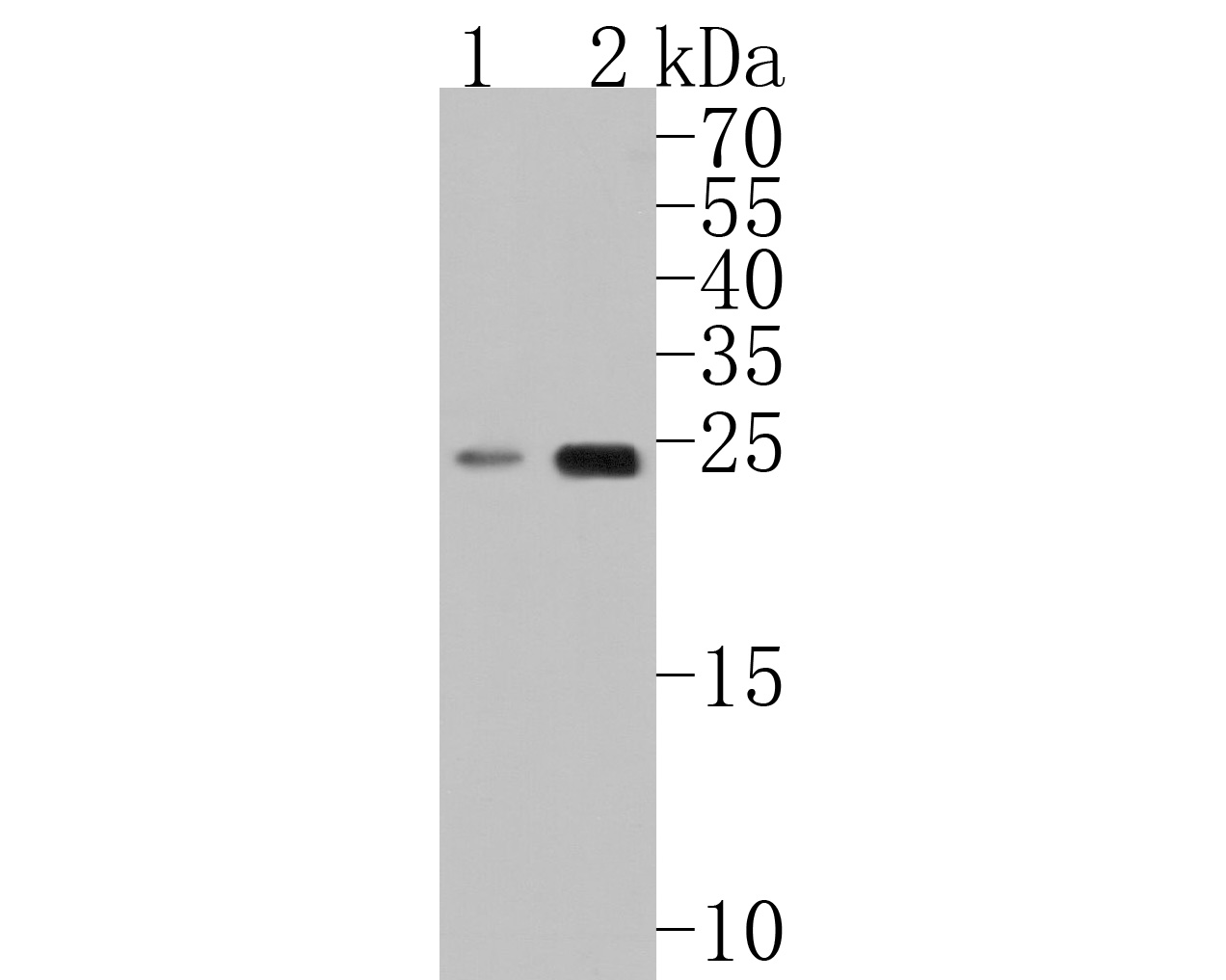 Western blot analysis of RPE on different lysates. Proteins were transferred to a PVDF membrane and blocked with 5% BSA in PBS for 1 hour at room temperature. The primary antibody (HA500234, 1/500) was used in 5% BSA at room temperature for 2 hours. Goat Anti-Rabbit IgG - HRP Secondary Antibody (HA1001) at 1:200,000 dilution was used for 1 hour at room temperature.<br />
Positive control: <br />
Lane 1: Mouse heart tissue lysate<br />
Lane 2: Human heart tissue lysate