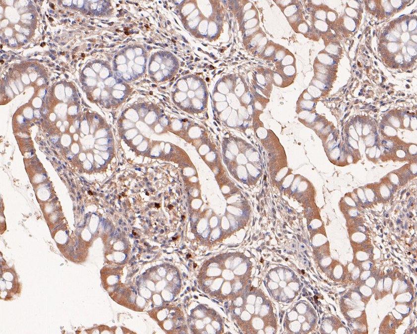 Immunohistochemical analysis of paraffin-embedded human small intestine tissue using anti-RPE antibody. The section was pre-treated using heat mediated antigen retrieval with Tris-EDTA buffer (pH 9.0) for 20 minutes.The tissues were blocked in 5% BSA for 30 minutes at room temperature, washed with ddH2O and PBS, and then probed with the primary antibody (HA500234, 1/400) for 30 minutes at room temperature. The detection was performed using an HRP conjugated compact polymer system. DAB was used as the chromogen. Tissues were counterstained with hematoxylin and mounted with DPX.