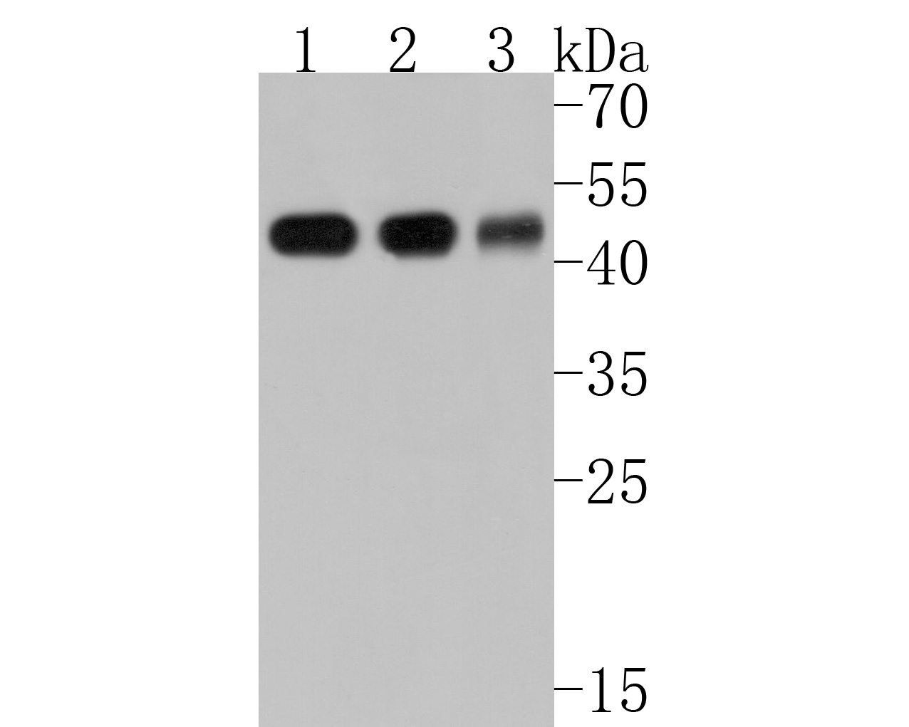 Western blot analysis of MAT1A on different lysates. Proteins were transferred to a PVDF membrane and blocked with 5% BSA in PBS for 1 hour at room temperature. The primary antibody (HA500232, 1/5,000) was used in 5% BSA at room temperature for 2 hours. Goat Anti-Rabbit IgG - HRP Secondary Antibody (HA1001) at 1:200,000 dilution was used for 1 hour at room temperature.<br />
Positive control: <br />
Lane 1: Mouse liver tissue lysate<br />
Lane 2: Rat liver tissue lysate<br />
Lane 3: Human liver tissue lysate
