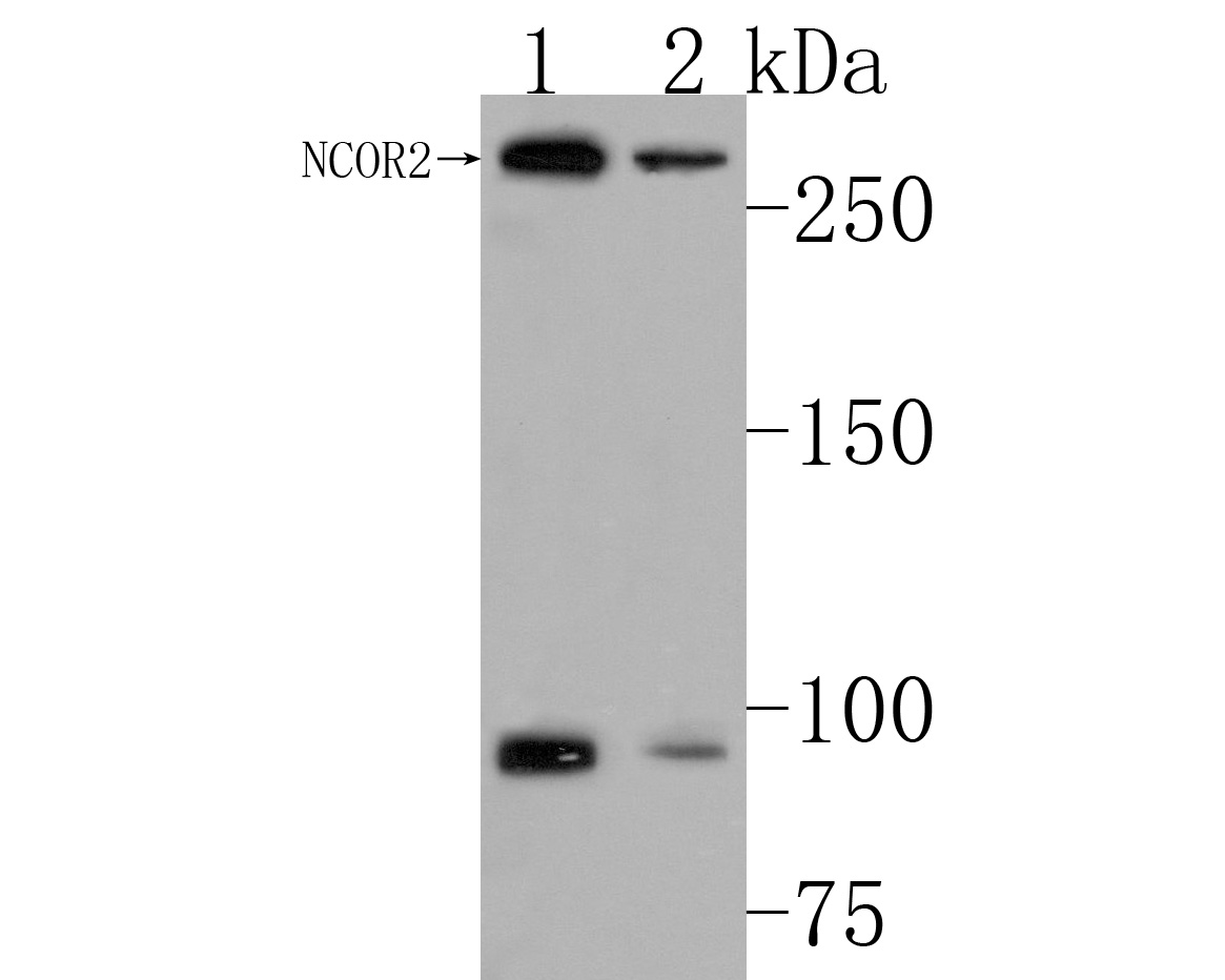 Western blot analysis of NCOR2/SMRT on different lysates. Proteins were transferred to a PVDF membrane and blocked with 5% BSA in PBS for 1 hour at room temperature. The primary antibody (HA500226, 1/1,000) was used in 5% BSA at room temperature for 2 hours. Goat Anti-Rabbit IgG - HRP Secondary Antibody (HA1001) at 1:200,000 dilution was used for 1 hour at room temperature.<br />
Positive control: <br />
Lane 1: Mouse brain tissue lysate<br />
Lane 2: Rat brain tissue lysate