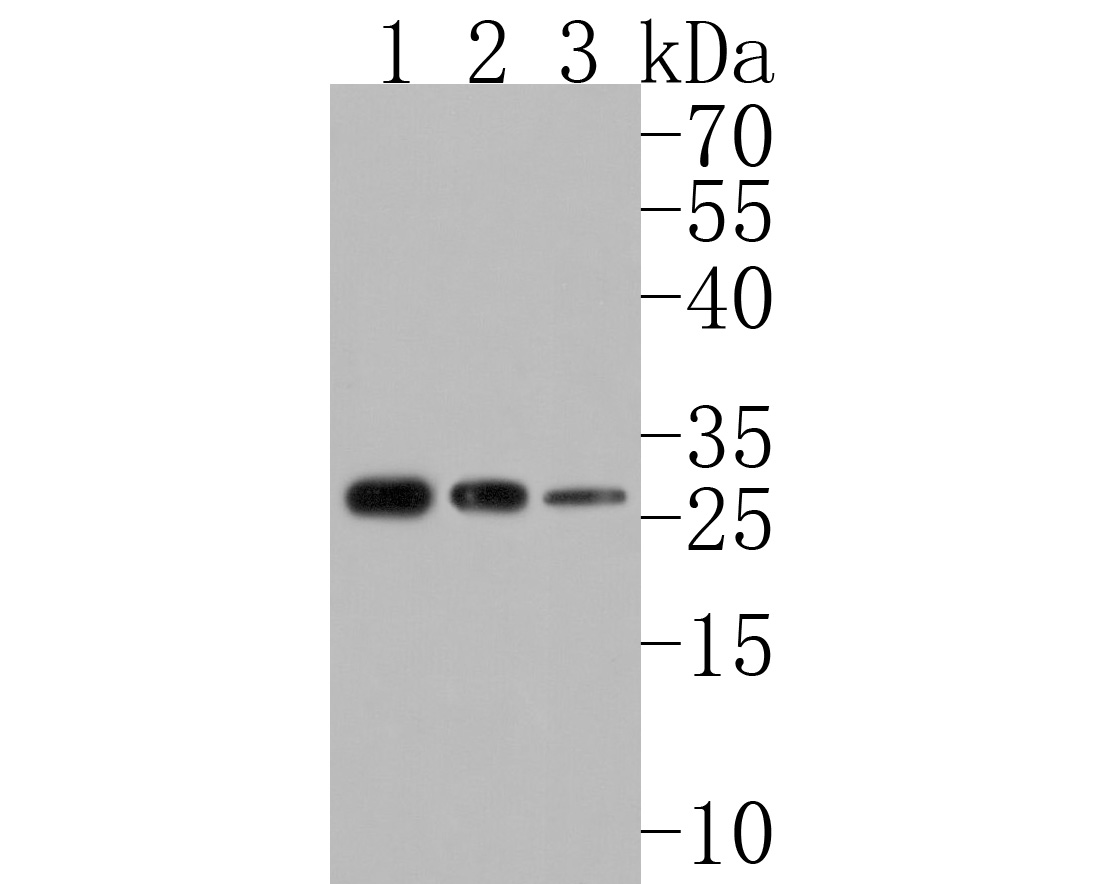 Western blot analysis of NC2 alpha on different lysates. Proteins were transferred to a PVDF membrane and blocked with 5% BSA in PBS for 1 hour at room temperature. The primary antibody (HA500224, 1/500) was used in 5% BSA at room temperature for 2 hours. Goat Anti-Rabbit IgG - HRP Secondary Antibody (HA1001) at 1:200,000 dilution was used for 1 hour at room temperature.<br />
Positive control: <br />
Lane 1: SW1990 cell lysate<br />
Lane 2: Jurkat cell lysate<br />
Lane 3: SK-Br-3 cell lysate
