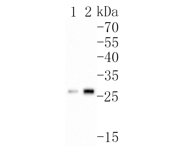 Western blot analysis of NC2 alpha on different lysates. Proteins were transferred to a PVDF membrane and blocked with 5% BSA in PBS for 1 hour at room temperature. The primary antibody (HA500224, 1/500) was used in 5% BSA at room temperature for 2 hours. Goat Anti-Rabbit IgG - HRP Secondary Antibody (HA1001) at 1:200,000 dilution was used for 1 hour at room temperature.<br />
Positive control: <br />
Lane 1: Mouse testis tissue lysate<br />
Lane 2: Rat testis tissue lysate