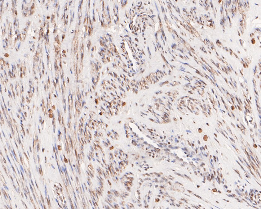 Immunohistochemical analysis of paraffin-embedded human cervix tissue using anti-NC2 alpha antibody. The section was pre-treated using heat mediated antigen retrieval with sodium citrate buffer (pH 6.0) for 20 minutes. The tissues were blocked in 1% BSA for 30 minutes at room temperature, washed with ddH2O and PBS, and then probed with the primary antibody (HA500224, 1/400)  for 30 minutes at room temperature. The detection was performed using an HRP conjugated compact polymer system. DAB was used as the chromogen. Tissues were counterstained with hematoxylin and mounted with DPX.