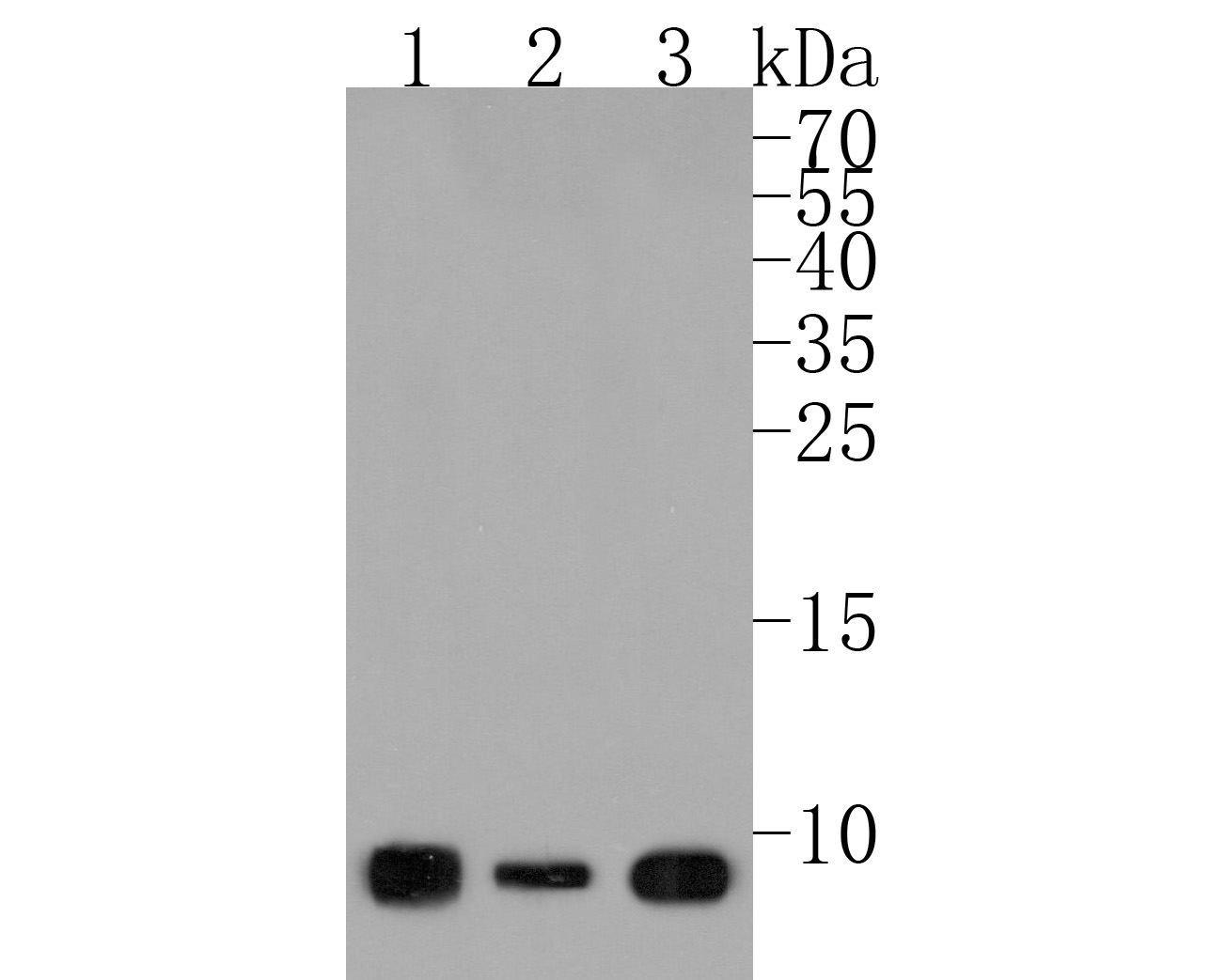 Western blot analysis of Cytochrome b-c1 complex subunit 9/UQCR10 on different lysates. Proteins were transferred to a PVDF membrane and blocked with 5% BSA in PBS for 1 hour at room temperature. The primary antibody (HA500222, 1/500) was used in 5% BSA at room temperature for 2 hours. Goat Anti-Rabbit IgG - HRP Secondary Antibody (HA1001) at 1:200,000 dilution was used for 1 hour at room temperature.<br />
Positive control: <br />
Lane 1: MCF-7 cell lysate<br />
Lane 2: Human skeletal muscle tissue lysate<br />
Lane 3: Hela cell lysate
