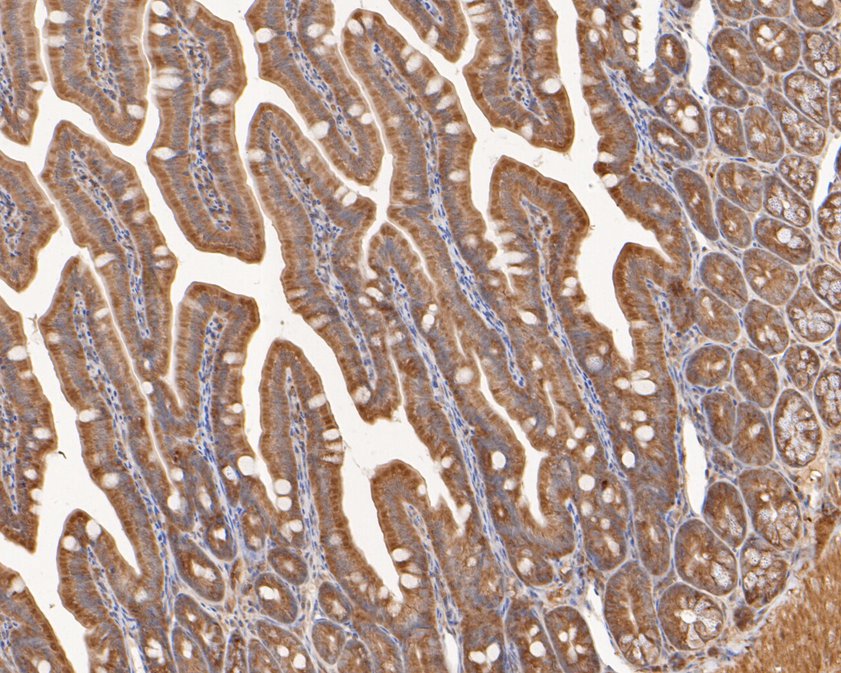 Immunohistochemical analysis of paraffin-embedded mouse colon tissue using anti-p53R2 antibody. The section was pre-treated using heat mediated antigen retrieval with sodium citrate buffer (pH 6.0) for 20 minutes. The tissues were blocked in 1% BSA for 30 minutes at room temperature, washed with ddH2O and PBS, and then probed with the primary antibody (HA500218, 1/400)  for 30 minutes at room temperature. The detection was performed using an HRP conjugated compact polymer system. DAB was used as the chromogen. Tissues were counterstained with hematoxylin and mounted with DPX.