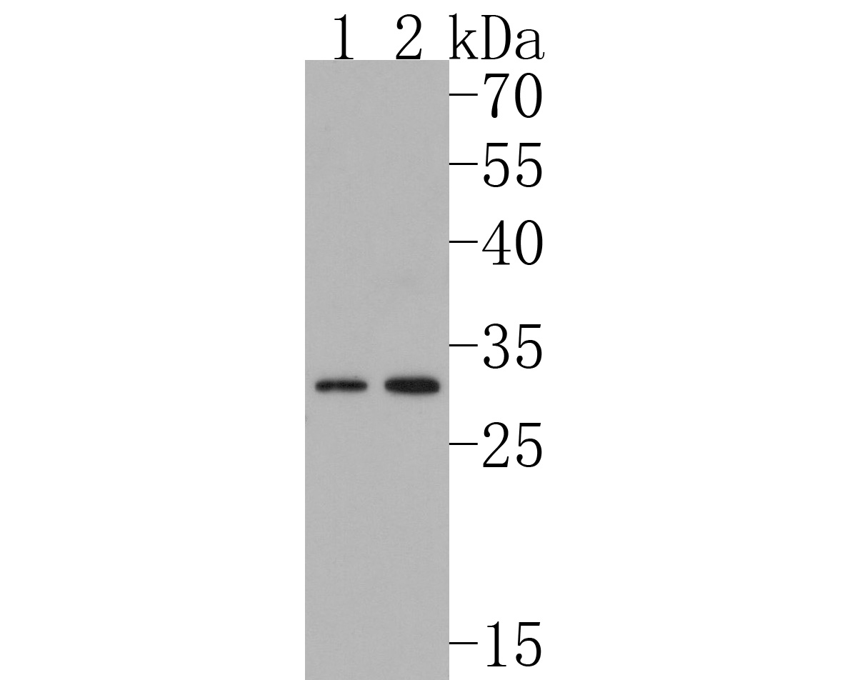 Western blot analysis of KCNK6 on different lysates. Proteins were transferred to a PVDF membrane and blocked with 5% BSA in PBS for 1 hour at room temperature. The primary antibody (HA500213, 1/1,000) was used in 5% BSA at room temperature for 2 hours. Goat Anti-Rabbit IgG - HRP Secondary Antibody (HA1001) at 1:200,000 dilution was used for 1 hour at room temperature.<br />
Positive control: <br />
Lane 1: Jurkat cell lysate<br />
Lane 2: Rat ovary tissue lysate