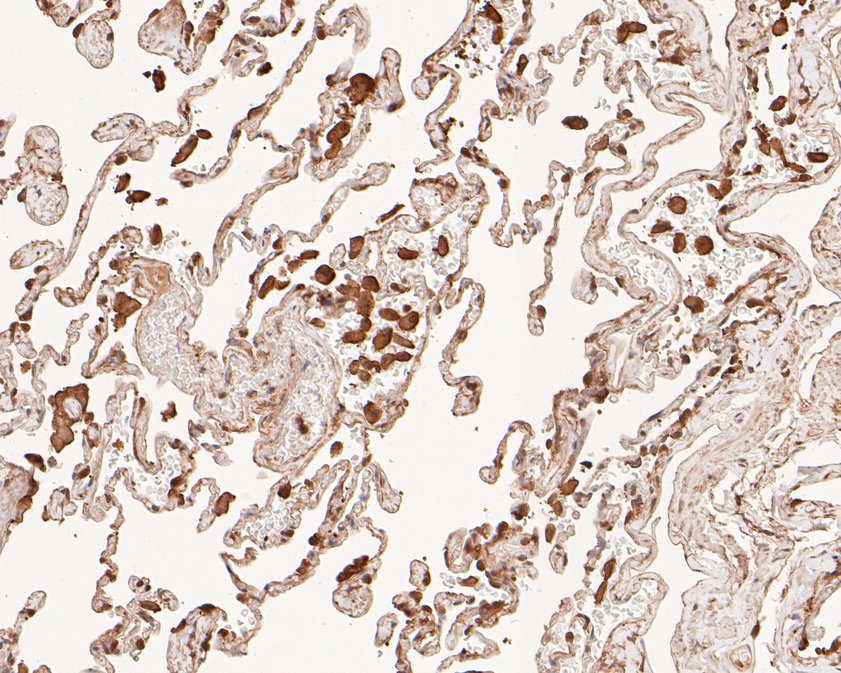 Immunohistochemical analysis of paraffin-embedded human lung tissue using anti-SREBP1 antibody. The section was pre-treated using heat mediated antigen retrieval with sodium citrate buffer (pH 6.0) for 20 minutes. The tissues were blocked in 5% BSA for 30 minutes at room temperature, washed with ddH2O and PBS, and then probed with the primary antibody (HA500210, 1/400)  for 30 minutes at room temperature. The detection was performed using an HRP conjugated compact polymer system. DAB was used as the chromogen. Tissues were counterstained with hematoxylin and mounted with DPX.