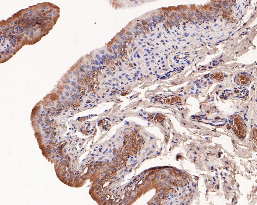 Immunohistochemical analysis of paraffin-embedded rat bladder tissue using anti-Cannabinoid Receptor I antibody. The section was pre-treated using heat mediated antigen retrieval with Tris-EDTA buffer (pH 8.0-8.4) for 20 minutes.The tissues were blocked in 5% BSA for 30 minutes at room temperature, washed with ddH2O and PBS, and then probed with the primary antibody (HA500206, 1/400) for 30 minutes at room temperature. The detection was performed using an HRP conjugated compact polymer system. DAB was used as the chromogen. Tissues were counterstained with hematoxylin and mounted with DPX.