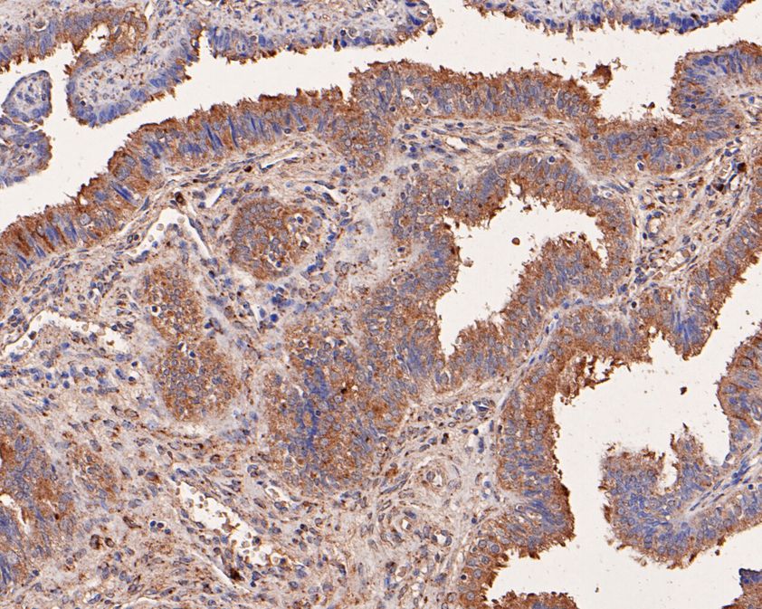 Immunohistochemical analysis of paraffin-embedded human fallopian tube tissue using anti-NMBR antibody. The section was pre-treated using heat mediated antigen retrieval with Tris-EDTA buffer (pH 9.0) for 20 minutes.The tissues were blocked in 1% BSA for 30 minutes at room temperature, washed with ddH2O and PBS, and then probed with the primary antibody (HA500253, 1/400) for 30 minutes at room temperature. The detection was performed using an HRP conjugated compact polymer system. DAB was used as the chromogen. Tissues were counterstained with hematoxylin and mounted with DPX.