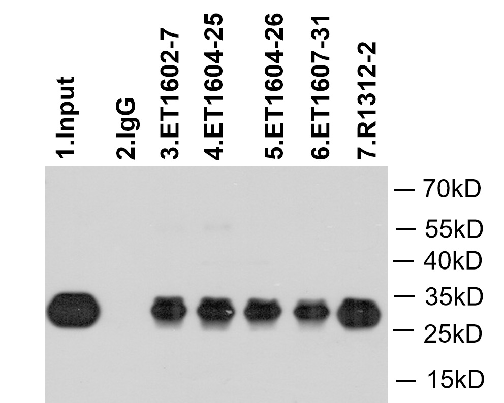 GFP tag was immunoprecipitated in 5µg GFP Tag fusion protein lysate with ET1602-7 at 2 µg/20 µl agarose. Western blot was performed from the immunoprecipitate using M1004-8 at 1/1,000 dilution. Anti-Mouse IgG - HRP Secondary Antibody (HA1006) at 1/20,000 dilution was used for 60 mins at room temperature.<br />
<br />
Lane 1: GFP Tag fusion protein lysate (input).<br />
Lane 2: Rabbit IgG instead of ET1602-7 in GFP Tag fusion protein lysate.<br />
Lane 3: ET1602-7 IP in GFP Tag fusion protein lysate.<br />
Lane 4: ET1604-25 IP in GFP Tag fusion protein lysate.<br />
Lane 5: ET1604-26 IP in GFP Tag fusion protein lysate.<br />
Lane 6: ET1607-31 IP in GFP Tag fusion protein lysate.<br />
Lane 7: R1312-2 IP in GFP Tag fusion protein lysate.<br />
<br />
Blocking/Dilution buffer: 5% NFDM/TBST